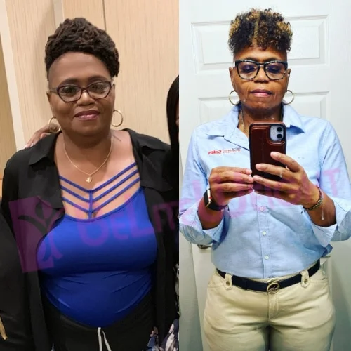 Leslie Y - 1 Year Update*